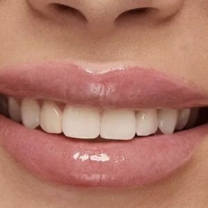 KIKO MILANO HYDRA Glossy Lip Set 03 – lūpų blizgių rinkinys