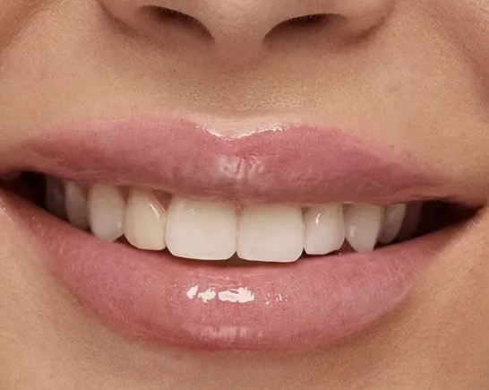 KIKO MILANO HYDRA Glossy Lip Set 03 – lūpų blizgių rinkinys